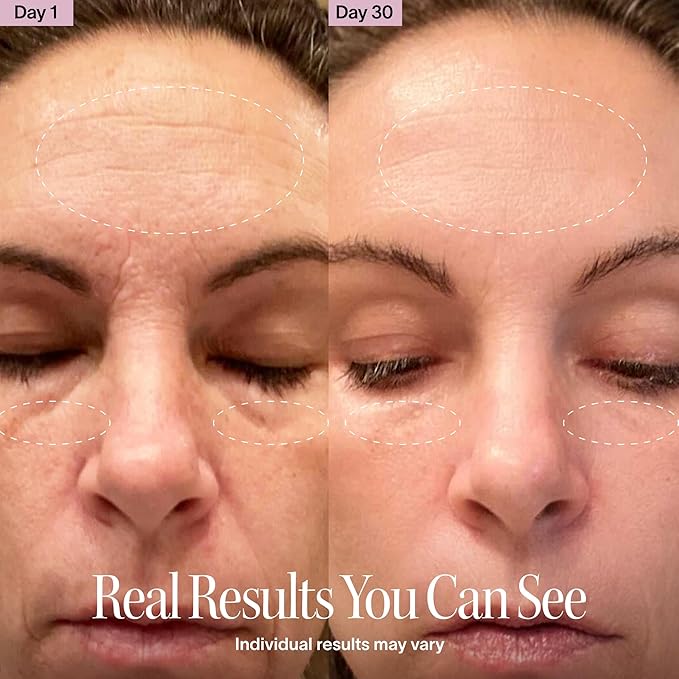 Red Light Therapy Wand 7-in-1 Face Eyes Neck Women