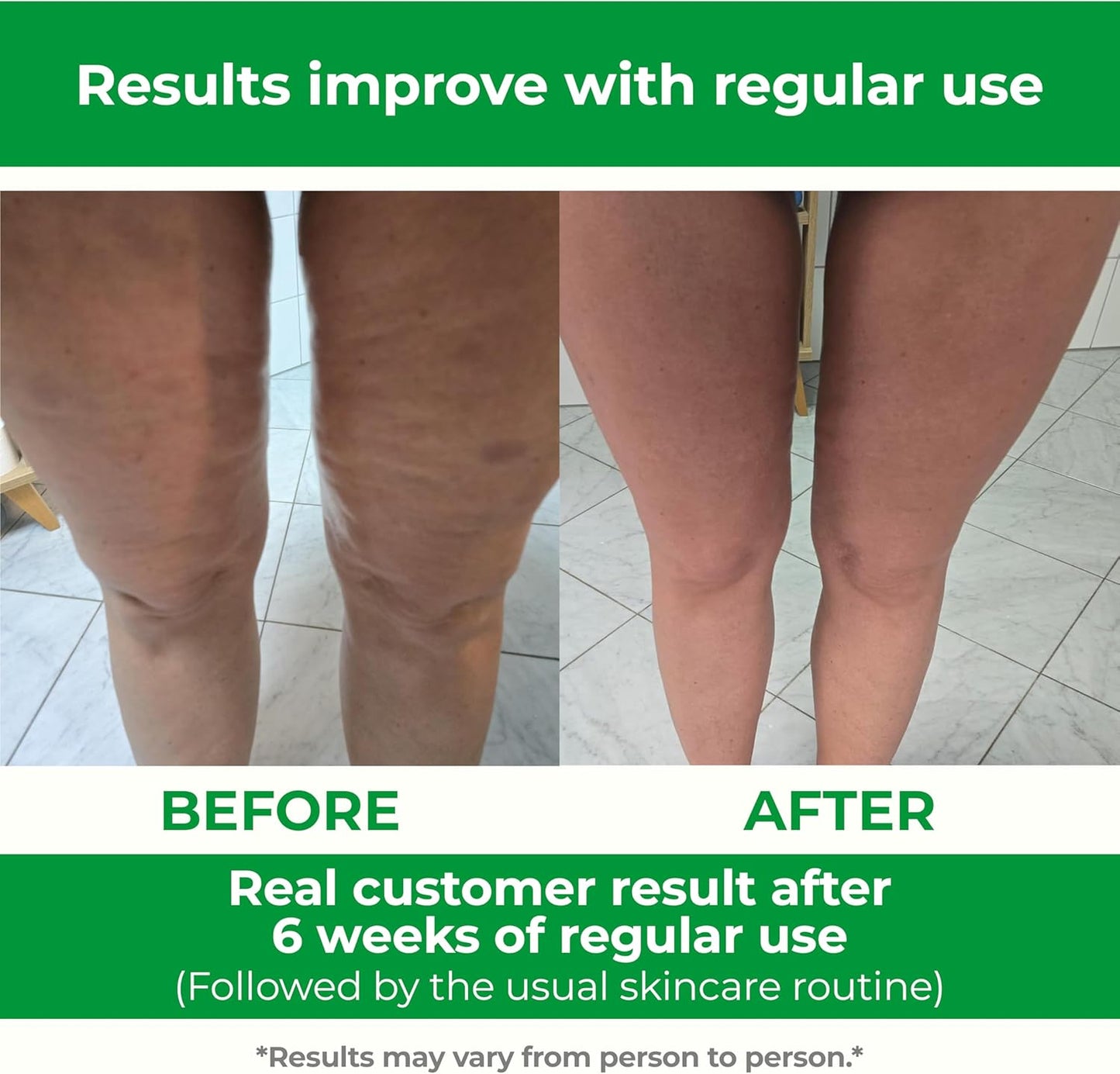 TESMED Cellulite Manual Massager : Made in Italy, Patented with Converging & Diverging Roller Technology. Anti Cellulite Roller for Thighs and Buttock