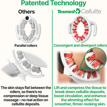 TESMED Cellulite Manual Massager : Made in Italy, Patented with Converging & Diverging Roller Technology. Anti Cellulite Roller for Thighs and Buttock