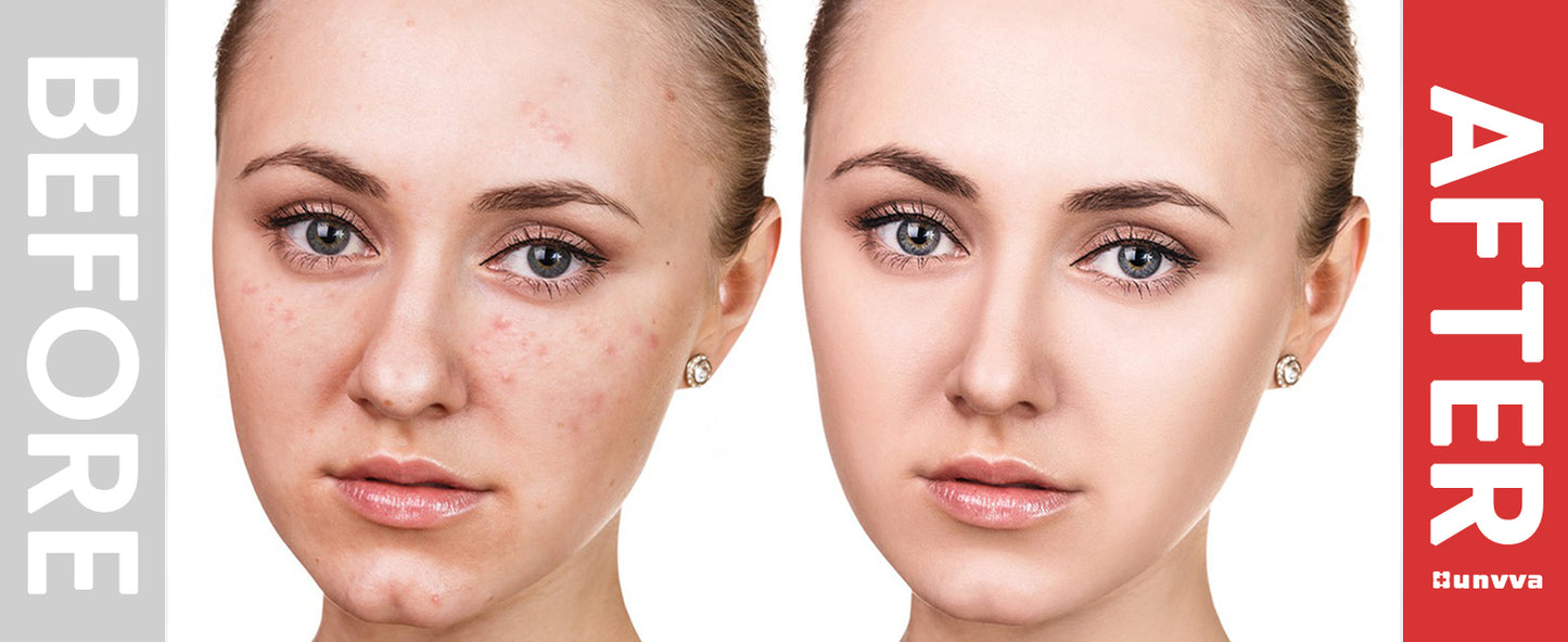 Microcurrent Face Lift Device EMS Anti-Aging Women