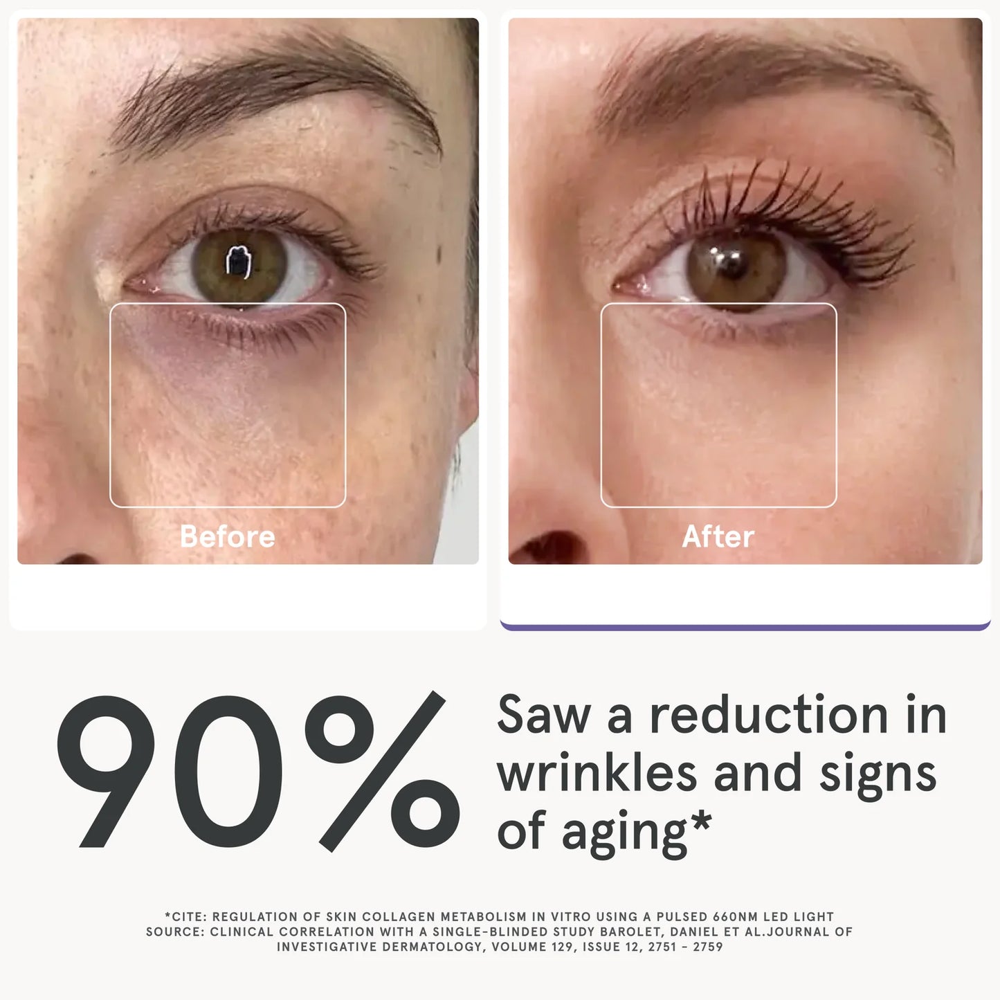 LED Light Therapy Eye Mask Red Blue Anti-Aging Women