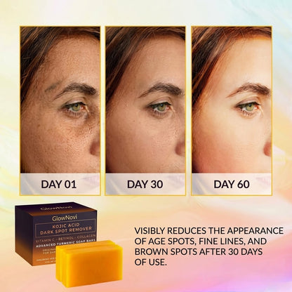 Kojic Acid Cleansing Soap with Vitamin C & Turmeric – 2 Pack