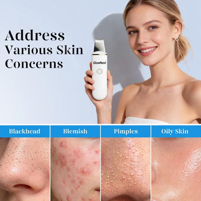 Ultrasonic Skin Scrubber Blackhead Removal Women